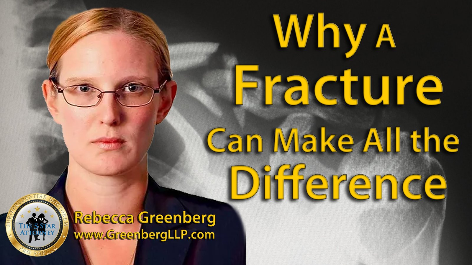 Why A Fracture Can Make All the Difference, GreenbergLLP video produced by NewlingCo LLC